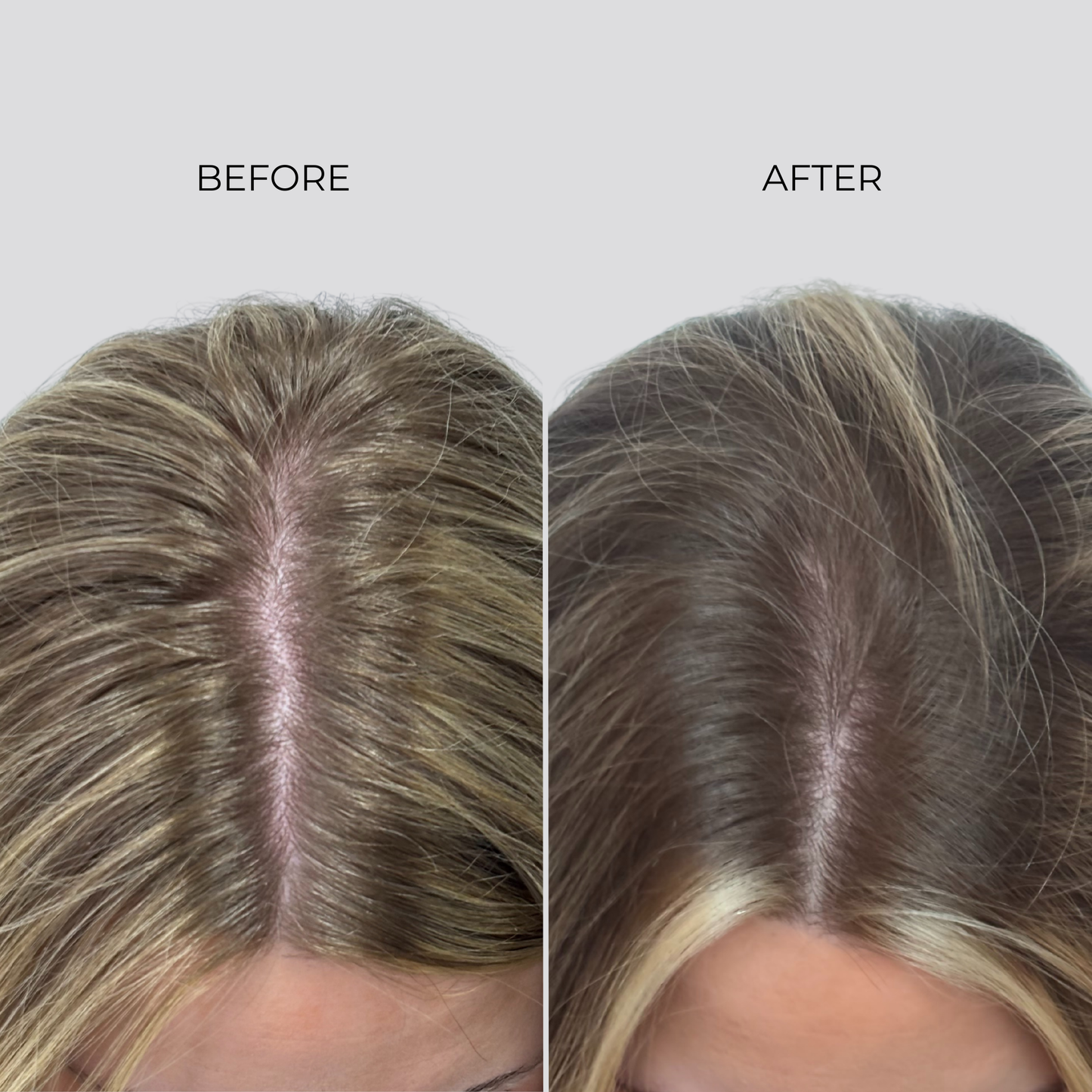 NANOGEN HAIR GROWTH FACTOR SERUM - 90 Day Treatment - Nanogen