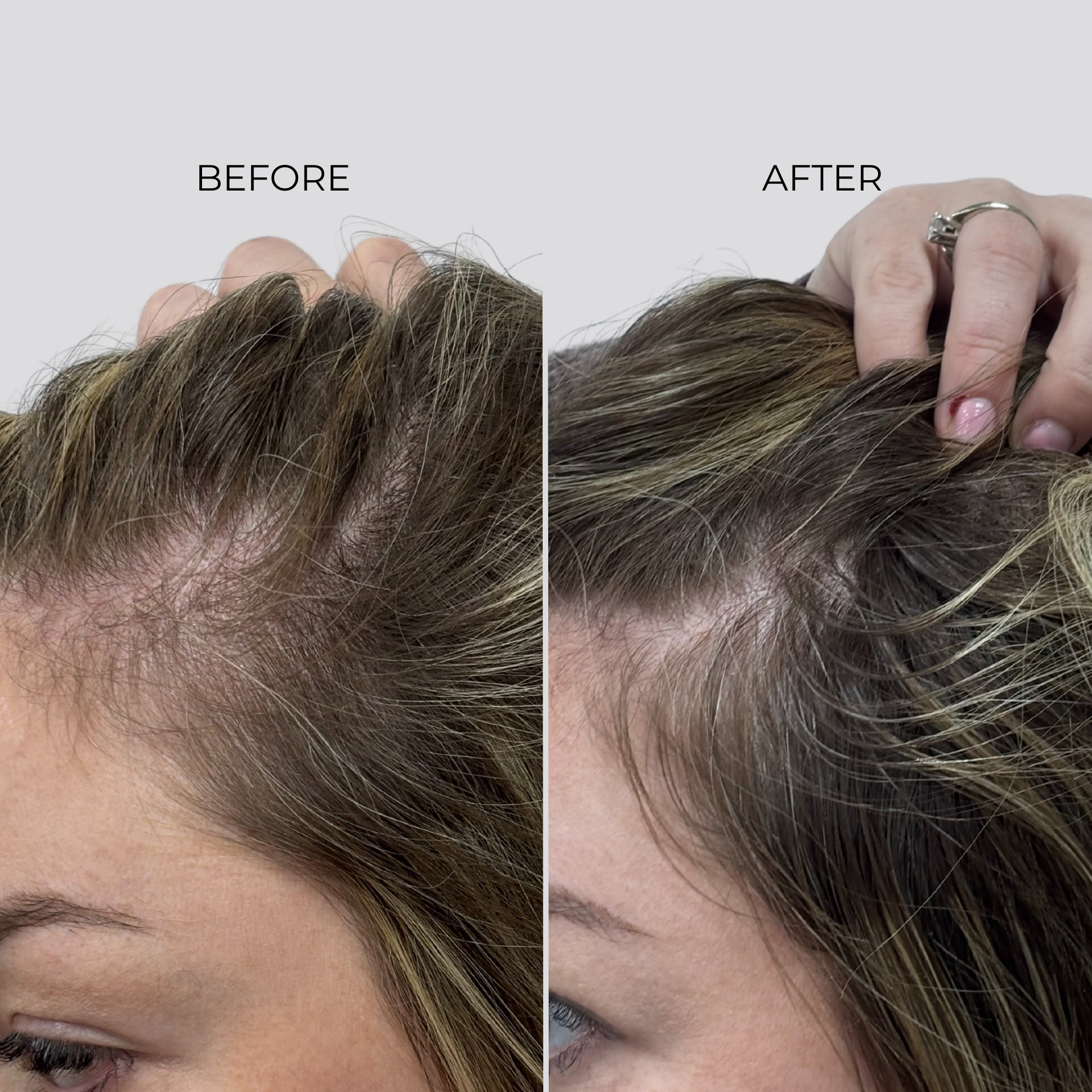 NANOGEN HAIR GROWTH FACTOR SERUM - 90 Day Treatment - Nanogen