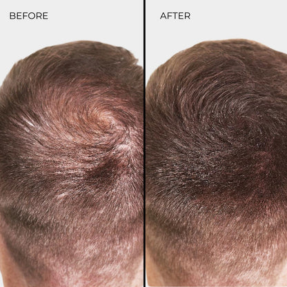 NANOGEN HAIR FIBRES - Auburn