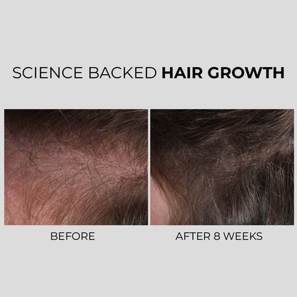 NANOGEN HAIR GROWTH FACTOR SERUM - dont delete - Nanogen