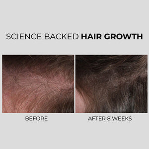 NANOGEN HAIR GROWTH FACTOR SERUM - dont delete - Nanogen