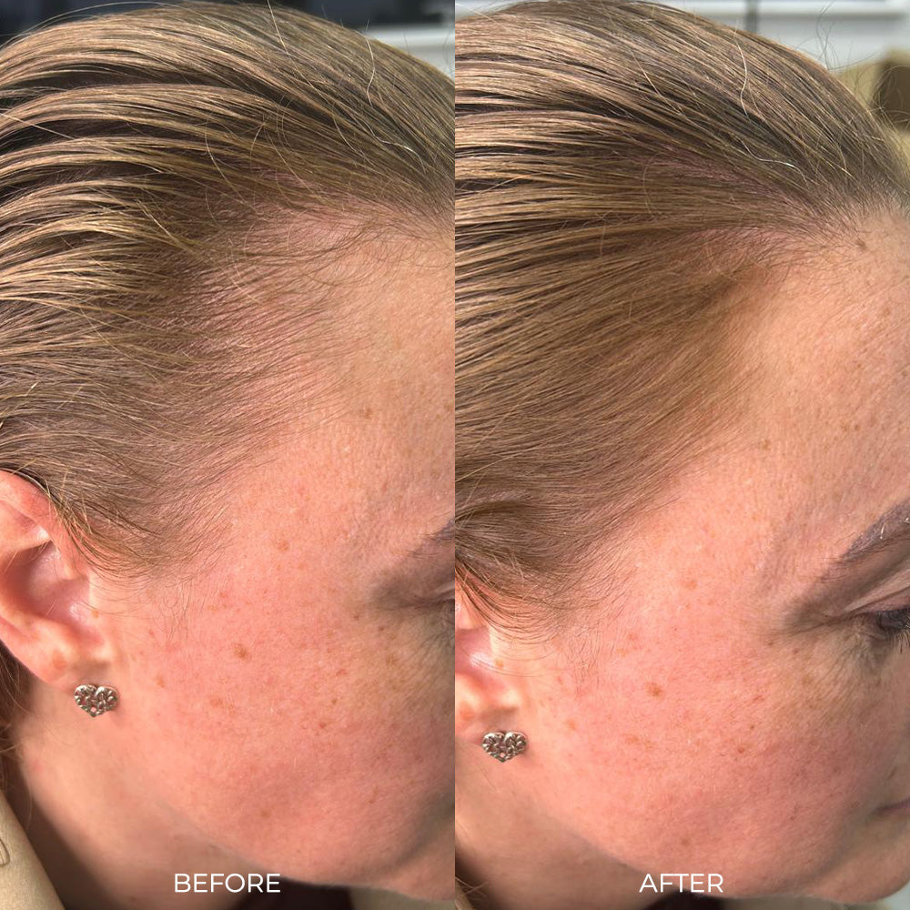 Nanogen Root Concealer - Light Blonde - Nanogen