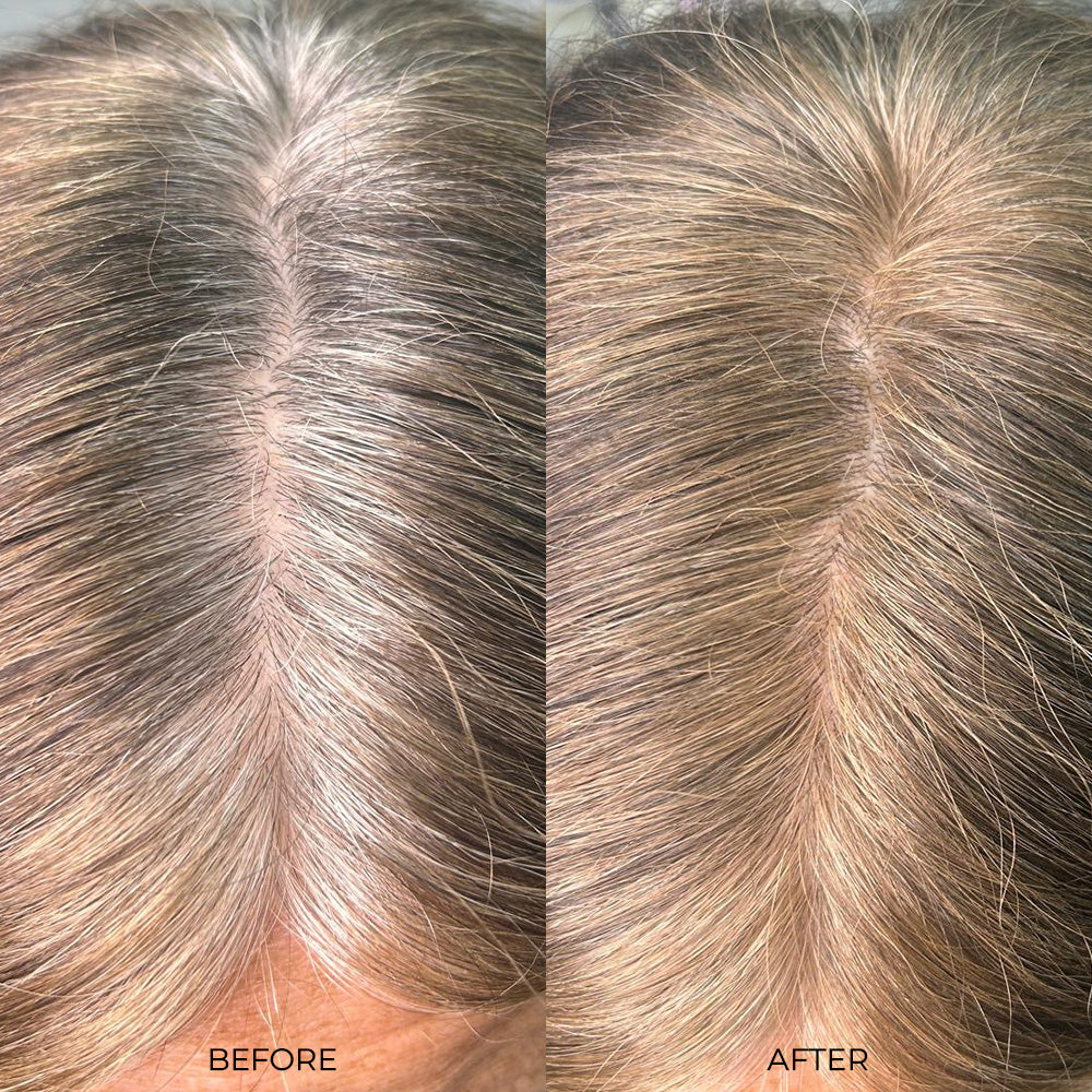 Nanogen Root Concealer - Light Blonde - Nanogen