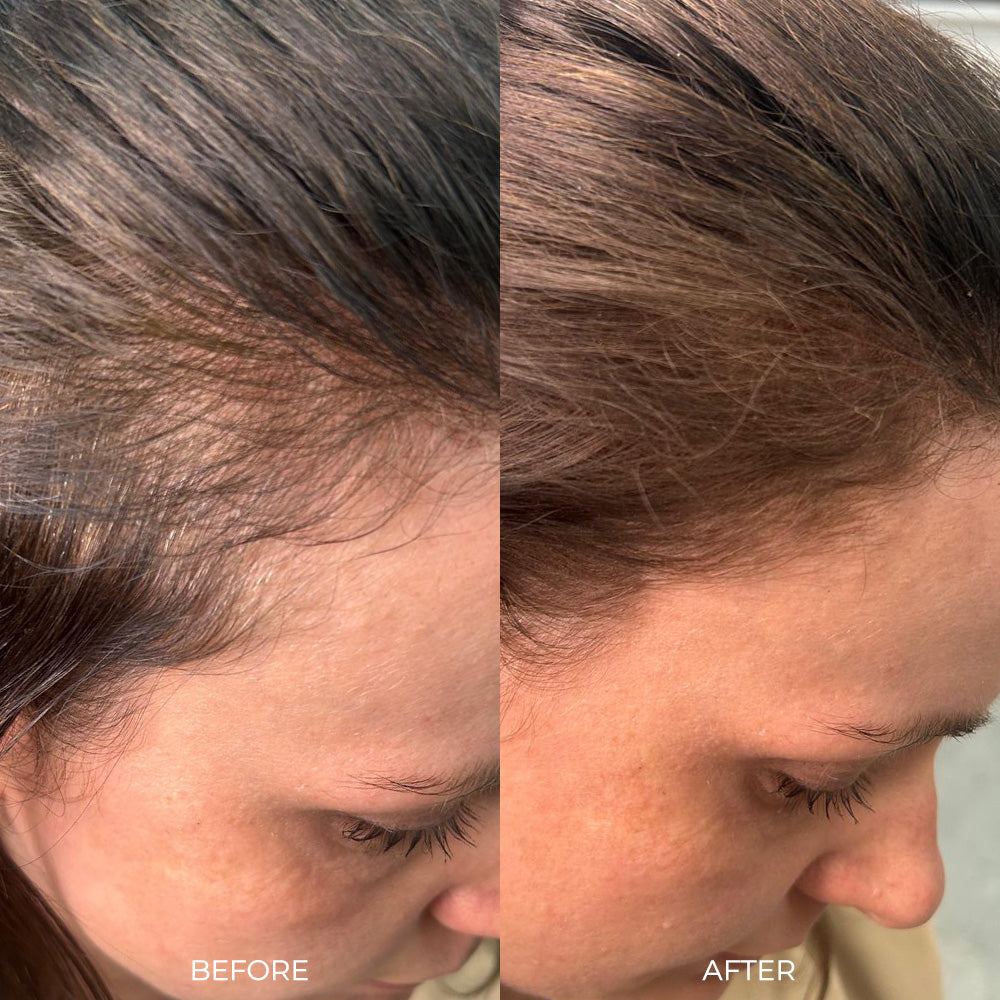 Nanogen Root Concealer - Light Blonde - Nanogen