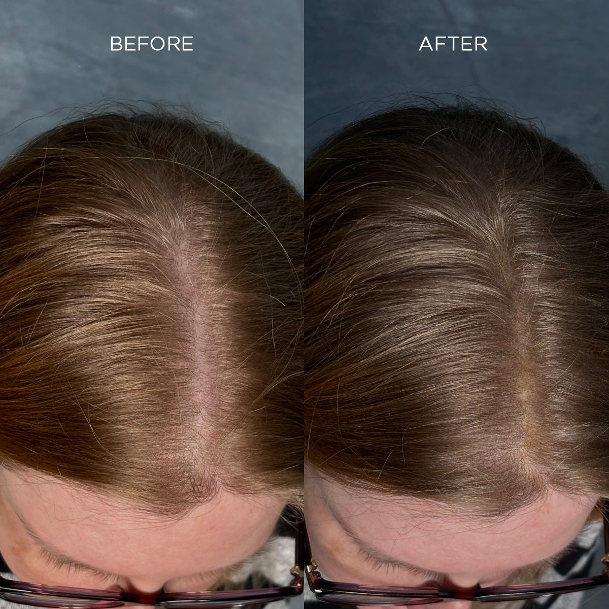 NANOGEN HAIR FIBRES - Medium Brown