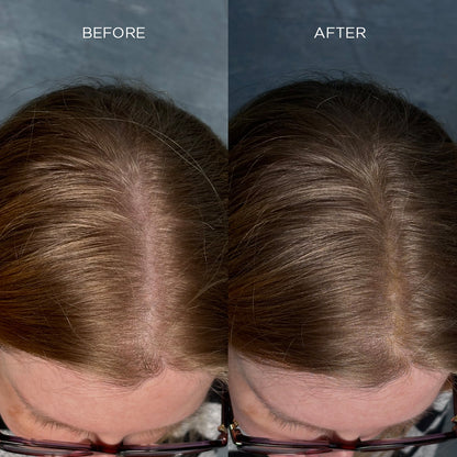 NANOGEN HAIR FIBRES - Medium Brown