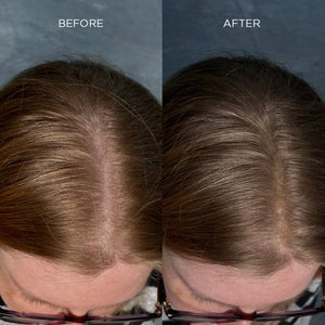 NANOGEN HAIR FIBRES - Medium Brown