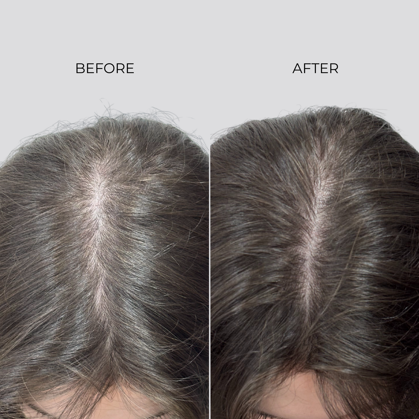 NANOGEN HAIR GROWTH FACTOR SERUM - 90 Day Treatment - Nanogen