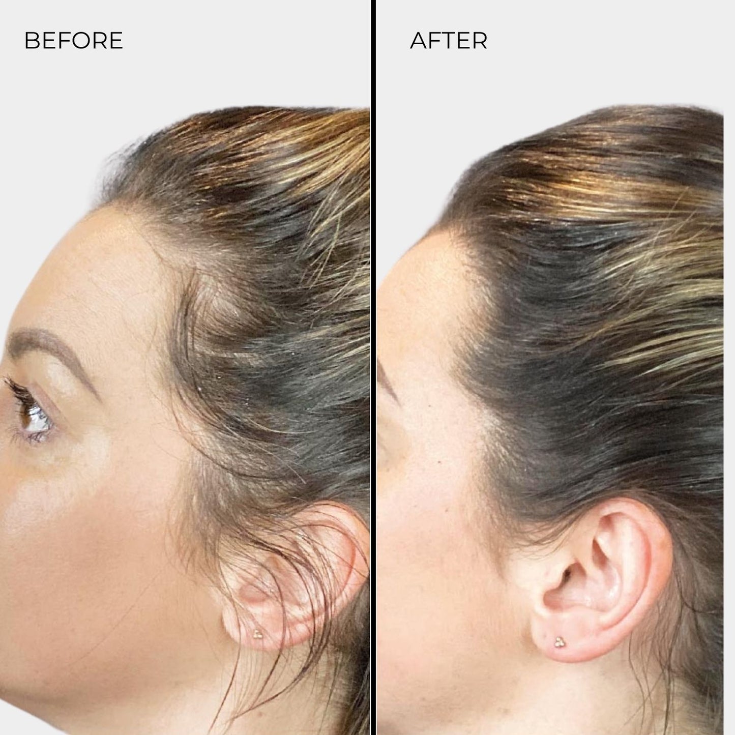 NANOGEN HAIR FIBRES - Dark Blonde