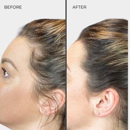 NANOGEN HAIR FIBRES - Dark Blonde