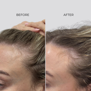 NANOGEN HAIR GROWTH FACTOR SERUM - 90 Day Treatment - Nanogen