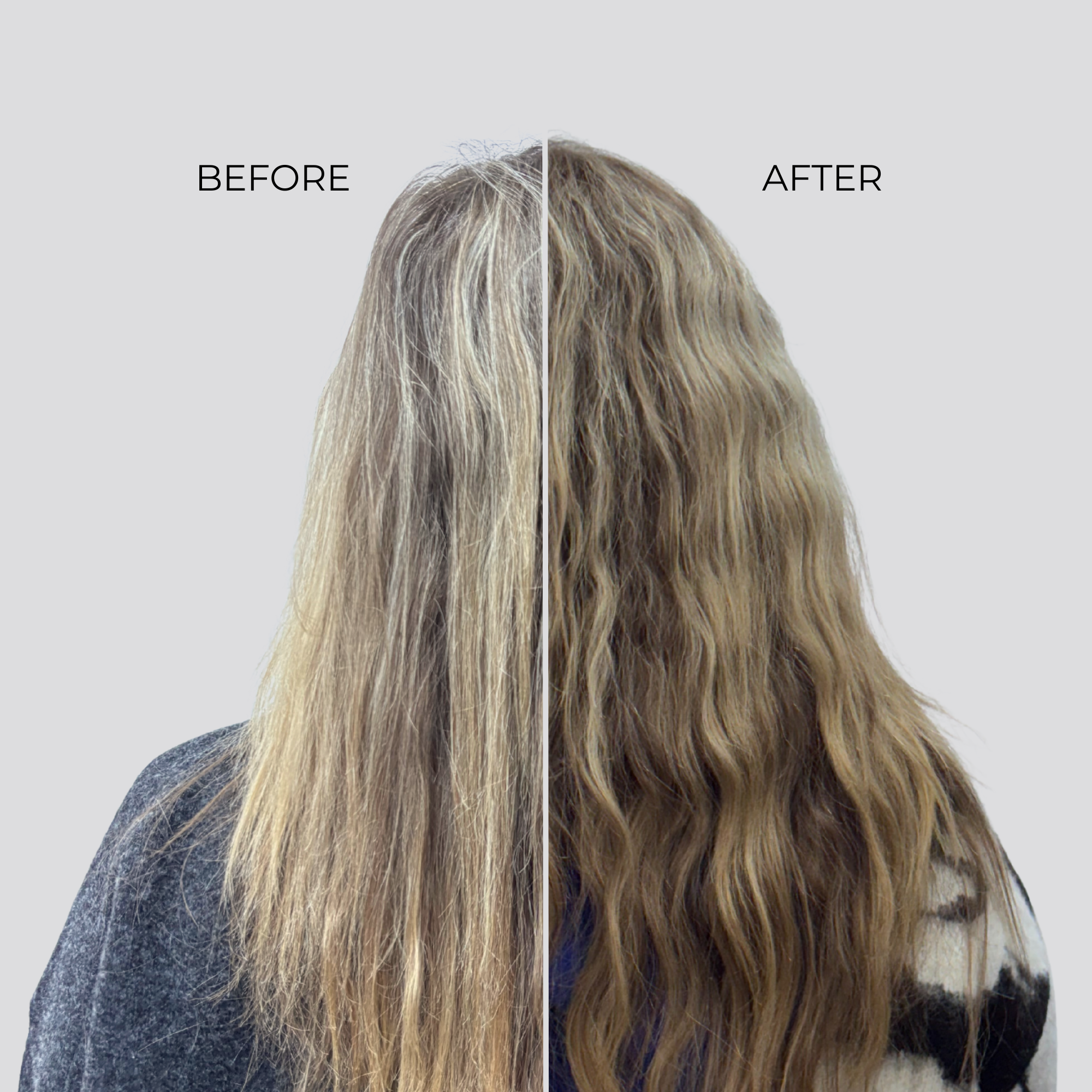 NANOGEN HAIR GROWTH FACTOR SERUM - 90 Day Treatment - Nanogen
