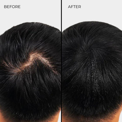NANOGEN HAIR FIBRES - White