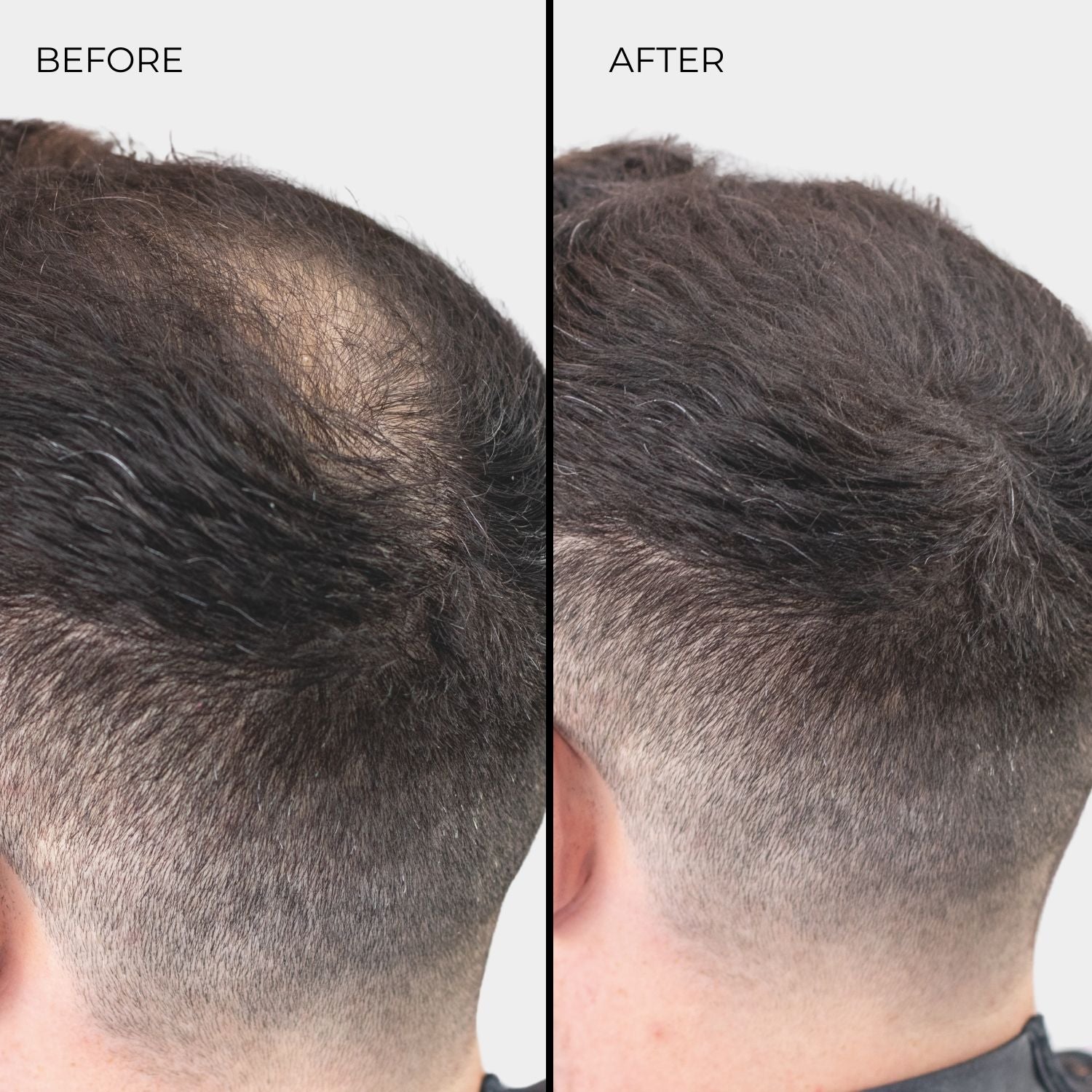 NANOGEN HAIR FIBRES - Grey - Nanogen
