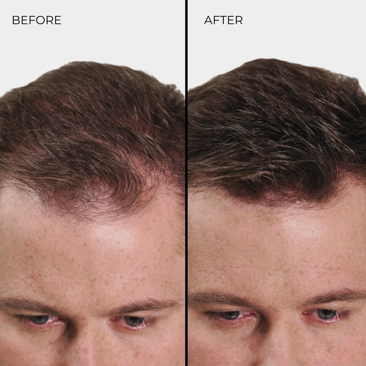 NANOGEN HAIR FIBRES - Light Blonde
