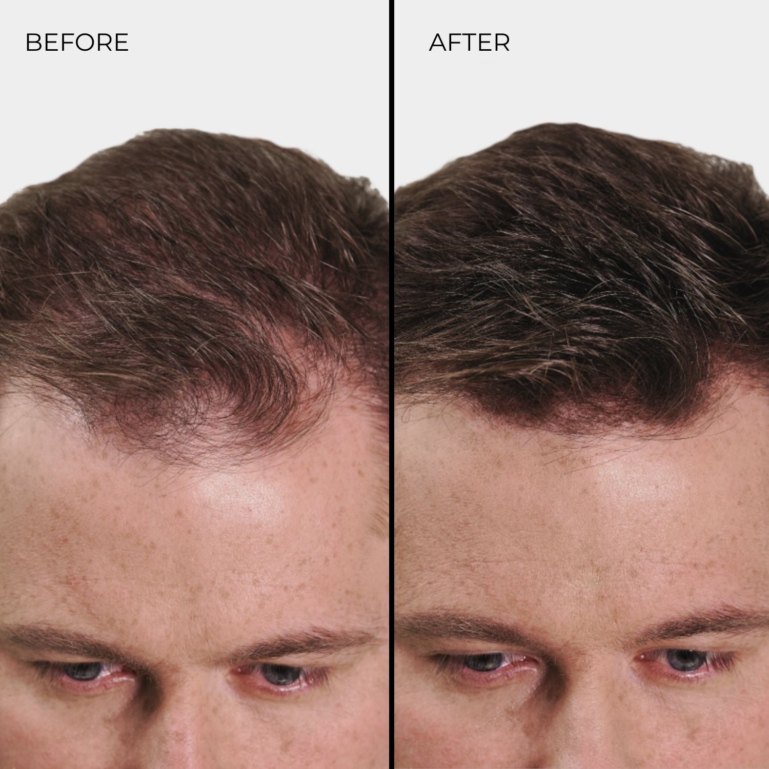 NANOGEN HAIR FIBRES - Light Blonde - Nanogen