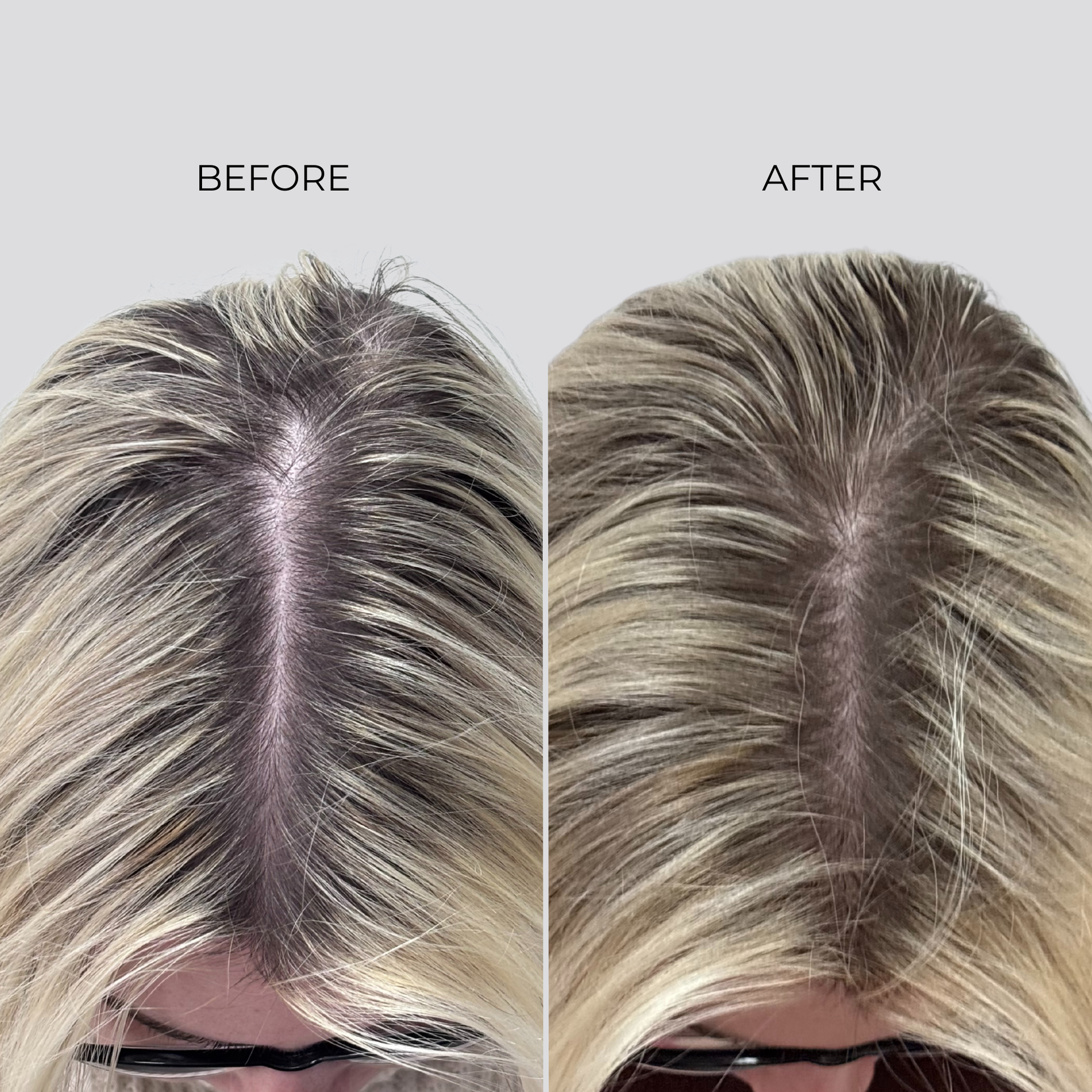 NANOGEN HAIR GROWTH FACTOR SERUM - 90 Day Treatment - Nanogen