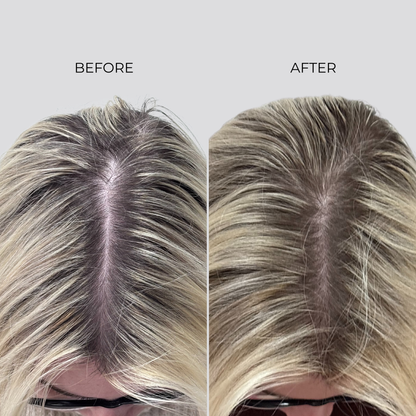 NANOGEN HAIR GROWTH FACTOR SERUM - 90 Day Treatment - Nanogen