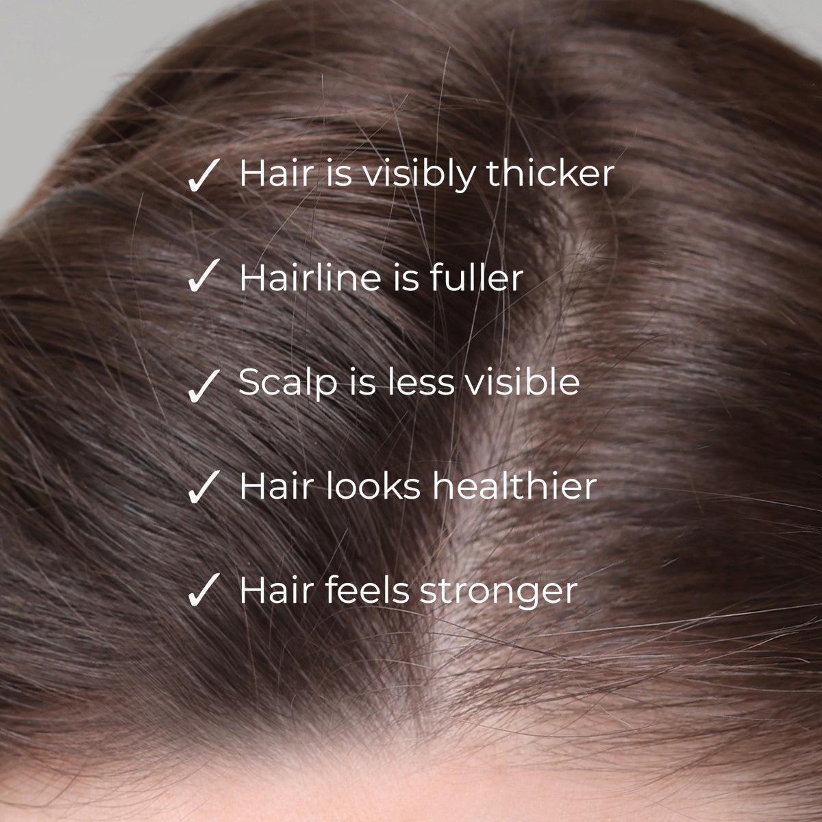 NANOGEN HAIR GROWTH FACTOR SERUM - dont delete - Nanogen