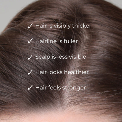 NANOGEN HAIR GROWTH FACTOR SERUM - dont delete - Nanogen