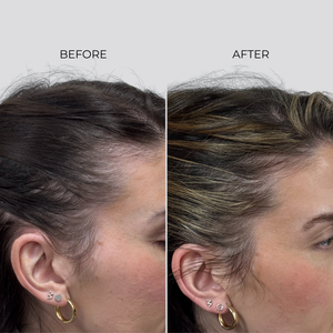 NANOGEN HAIR GROWTH FACTOR SERUM - 90 Day Treatment - Nanogen