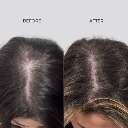 NANOGEN HAIR GROWTH FACTOR SERUM - 90 Day Treatment - Nanogen