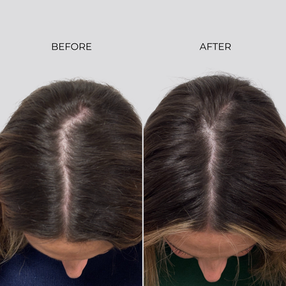 NANOGEN HAIR GROWTH FACTOR SERUM - 90 Day Treatment - Nanogen