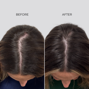 NANOGEN HAIR GROWTH FACTOR SERUM - 90 Day Treatment - Nanogen